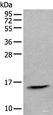 Western blot analysis of Human lymph gland tissue lysate  using CCL21 Polyclonal Antibody at dilution of 1:600