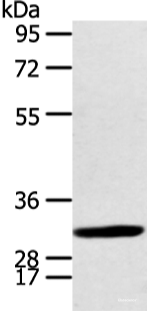 Western blot analysis of Human fetal brian tissue  using CALB2 Polyclonal Antibody at dilution of 1:400