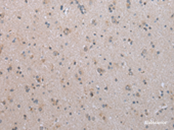 Immunohistochemistry of paraffin-embedded Human brain tissue  using COX17 Polyclonal Antibody at dilution of 1:45(×200)