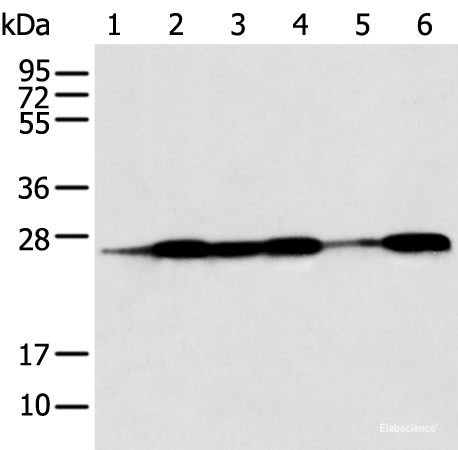 Western blot analysis of Human fetal muscle tissue HEPG2 Jurkat Hela A431 and A549 cell  using BAG2 Polyclonal Antibody at dilution of 1:550