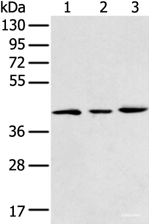 Western blot analysis of 293T K562 and Raji cell  using DCX Polyclonal Antibody at dilution of 1:400