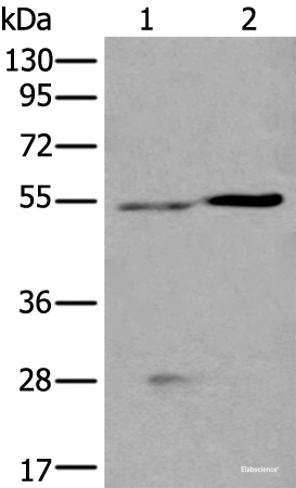 Western blot analysis of Human left kidney tissue and Human fetal liver tissue lysates  using DDC Polyclonal Antibody at dilution of 1:400