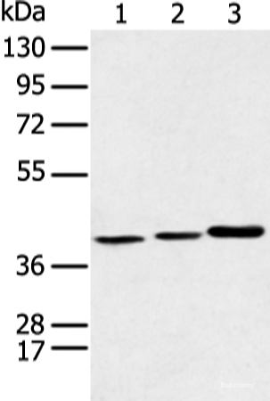 Western blot analysis of Human fetal liver tissue Hela cell and Human fetal brain tissue  using MORF4L1 Polyclonal Antibody at dilution of 1:350