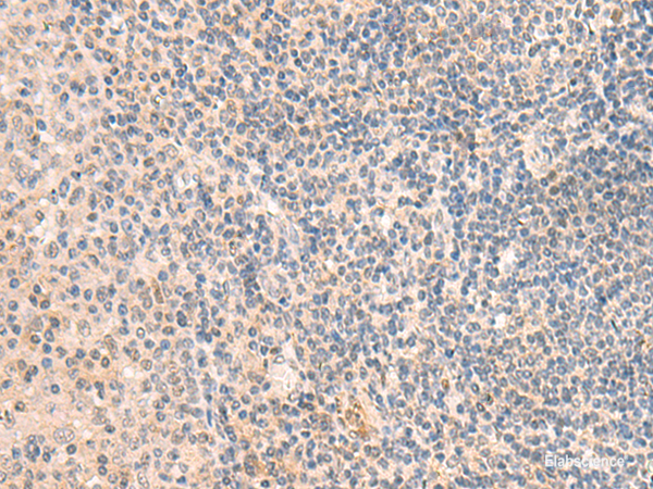 Immunohistochemistry of paraffin-embedded Human tonsil tissue  using GRM2 Polyclonal Antibody at dilution of 1:50(×200)