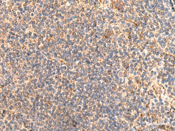 Immunohistochemistry of paraffin-embedded Human tonsil tissue  using ABHD2 Polyclonal Antibody at dilution of 1:40(×200)