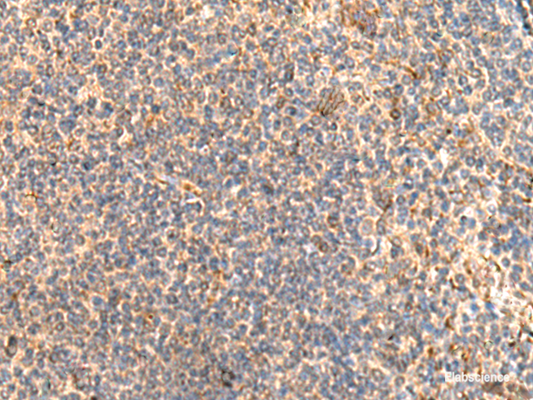 Immunohistochemistry of paraffin-embedded Human tonsil tissue  using ABHD2 Polyclonal Antibody at dilution of 1:40(×200)