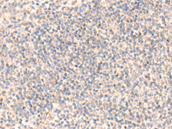 Immunohistochemistry of paraffin-embedded Human tonsil tissue  using ADAMTS2 Polyclonal Antibody at dilution of 1:45(×200)