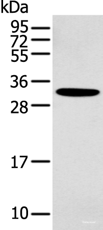 Western blot analysis of Mouse muscle tissue  using NANOS1 Polyclonal Antibody at dilution of 1:400
