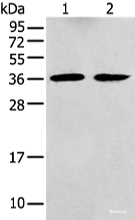 Western blot analysis of Mouse brain tissue and Human fetal brain tissue  using GNAI2 Polyclonal Antibody at dilution of 1:400