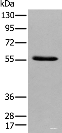 Western blot analysis of Human pancreas tissue  using GPC4 Polyclonal Antibody at dilution of 1:500