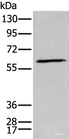 Western blot analysis of Human fetal brain tissue lysate  using GPC5 Polyclonal Antibody at dilution of 1:450