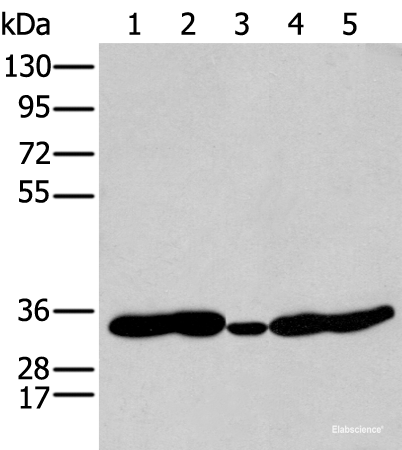Western blot analysis of 231 Mouse heart tissue Human fetal brain tissue Jurkat and Hepg2 cell  using HOXC11 Polyclonal Antibody at dilution of 1:250