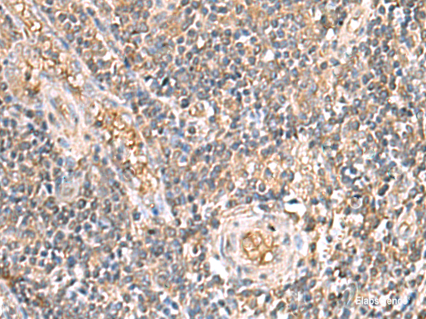 Immunohistochemistry of paraffin-embedded Human tonsil tissue  using ARF5 Polyclonal Antibody at dilution of 1:40(×200)