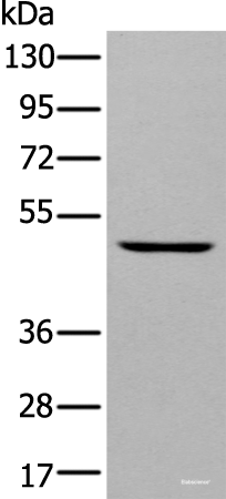 Western blot analysis of A431 cell  using DAPK2 Polyclonal Antibody at dilution of 1:400