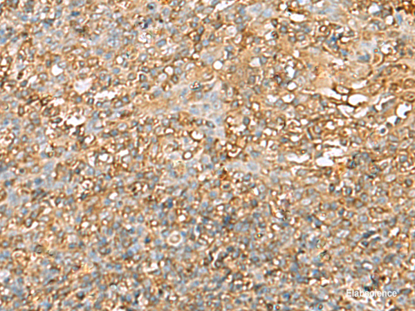 Immunohistochemistry of paraffin-embedded Human tonsil tissue  using LGALS9 Polyclonal Antibody at dilution of 1:40(×200)