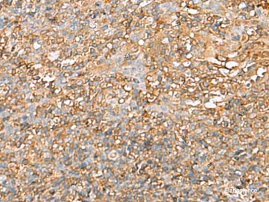 Immunohistochemistry of paraffin-embedded Human tonsil tissue  using LGALS9 Polyclonal Antibody at dilution of 1:40(×200)