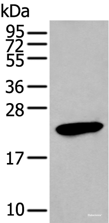 Western blot analysis of Human stomach tissue lysate  using GKN1 Polyclonal Antibody at dilution of 1:250
