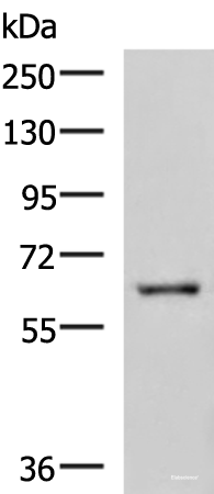 Western blot analysis of HepG2 cell lysate  using LILRB5 Polyclonal Antibody at dilution of 1:600