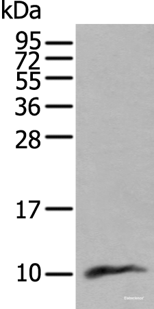 Western blot analysis of Human lung tissue lysate  using CCL18 Polyclonal Antibody at dilution of 1:400