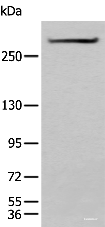 Western blot analysis of Mouse heart tissue lysate  using SPTA1 Polyclonal Antibody at dilution of 1:550