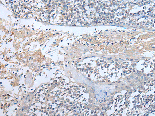 Immunohistochemistry of paraffin-embedded Human tonsil tissue  using ABR Polyclonal Antibody at dilution of 1:50(×200)