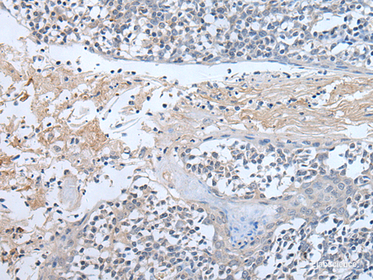 Immunohistochemistry of paraffin-embedded Human tonsil tissue  using ABR Polyclonal Antibody at dilution of 1:50(×200)