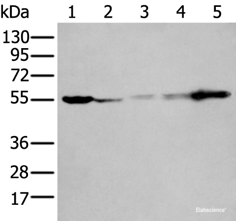 Western blot analysis of 293T A549 A431 Hela and Jurkat cell lysates  using PFKFB3 Polyclonal Antibody at dilution of 1:400