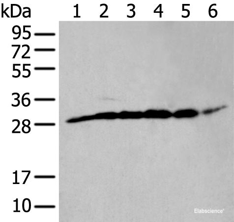 Western blot analysis of PC-3 cell mouse skeletal muscle tissue mouse brain tissue human heart tissue Hela and HEPG2 cell lysates  using ETFB Polyclonal Antibody at dilution of 1:400