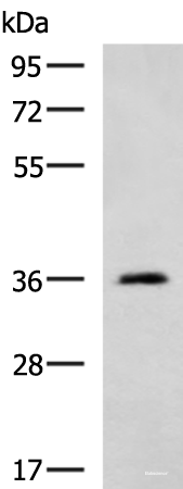 Western blot analysis of Human cerebella tissue lysate  using ATP1B2 Polyclonal Antibody at dilution of 1:650