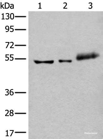Western blot analysis of Hela cell Mouse kidney tissue and Human colorectal cancer tissue lysates  using YY2 Polyclonal Antibody at dilution of 1:800