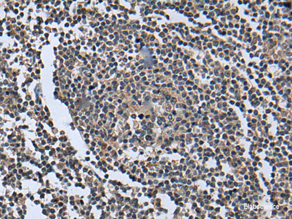 Immunohistochemistry of paraffin-embedded Human tonsil tissue  using WNT9B Polyclonal Antibody at dilution of 1:85(×200)