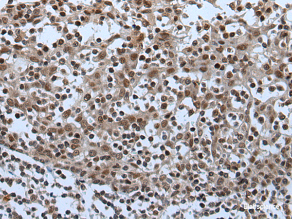 Immunohistochemistry of paraffin-embedded Human tonsil tissue  using CELF5 Polyclonal Antibody at dilution of 1:65(×200)