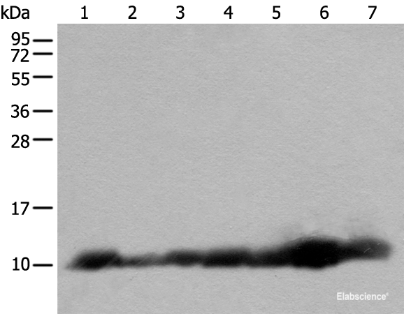 Western blot analysis of 293T and RAW264.7 cell Human fetal brain tissue Jurkat and 231 cell Human heart tissue Hela cell lysates  using C14orf2 Polyclonal Antibody at dilution of 1:600