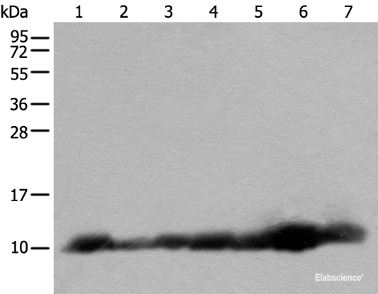 Western blot analysis of 293T and RAW264.7 cell Human fetal brain tissue Jurkat and 231 cell Human heart tissue Hela cell lysates  using C14orf2 Polyclonal Antibody at dilution of 1:600