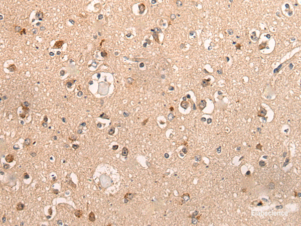 Immunohistochemistry of paraffin-embedded Human brain tissue  using DYNAP Polyclonal Antibody at dilution of 1:50(×200)