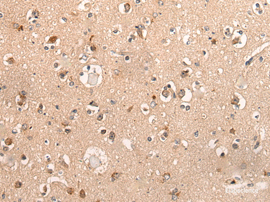 Immunohistochemistry of paraffin-embedded Human brain tissue  using DYNAP Polyclonal Antibody at dilution of 1:50(×200)