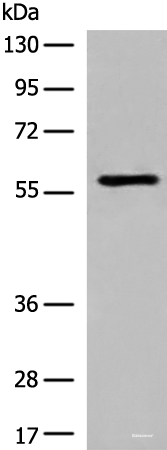Western blot analysis of Jurkat cell lysate  using M1AP Polyclonal Antibody at dilution of 1:600