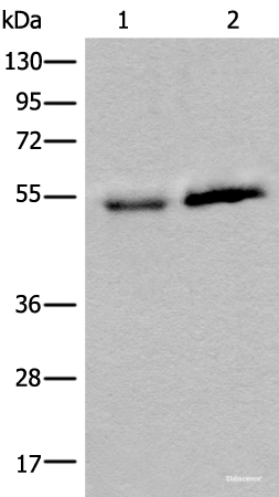 Western blot analysis of Human fetal intestines tissue and Human breast cancer tissue lysates  using CCDC85C Polyclonal Antibody at dilution of 1:400