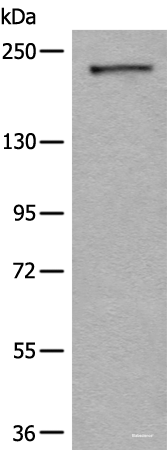 Western blot analysis of A172 cell lysate  using CDC42BPA Polyclonal Antibody at dilution of 1:600