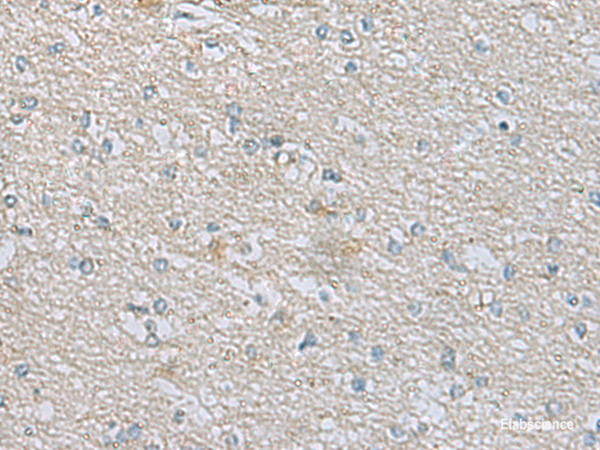 Immunohistochemistry of paraffin-embedded Human brain tissue  using CDH12 Polyclonal Antibody at dilution of 1:60(×200)