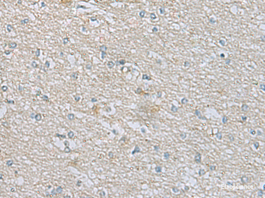 Immunohistochemistry of paraffin-embedded Human brain tissue  using CDH12 Polyclonal Antibody at dilution of 1:60(×200)