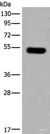 Western blot analysis of Mouse brain tissue lysate  using CDKL2 Polyclonal Antibody at dilution of 1:250