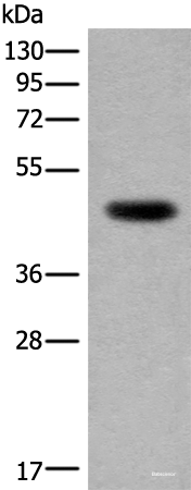 Western blot analysis of Human heart tissue lysate  using CDKL4 Polyclonal Antibody at dilution of 1:350