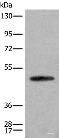Western blot analysis of Human cerebella tissue lysate  using CADM2 Polyclonal Antibody at dilution of 1:2000