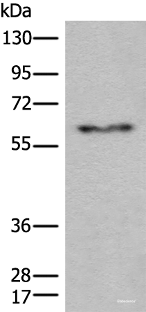 Western blot analysis of Human fetal liver tissue lysate  using CES2 Polyclonal Antibody at dilution of 1:600