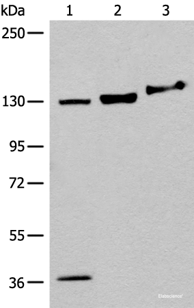 Western blot analysis of 293T cell Mouse brain tissue lysates  using EPHA6 Polyclonal Antibody at dilution of 1:500