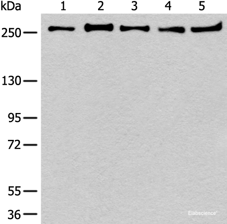 Western blot analysis of 293T K562 Raji Hela and NIH/3T3 cell lysates  using PRPF8 Polyclonal Antibody at dilution of 1:600