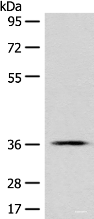 Western blot analysis of PC-3 cell lysate  using GPR55 Polyclonal Antibody at dilution of 1:500