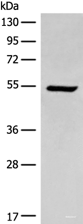Western blot analysis of HEPG2 cell lysate  using ACD Polyclonal Antibody at dilution of 1:400