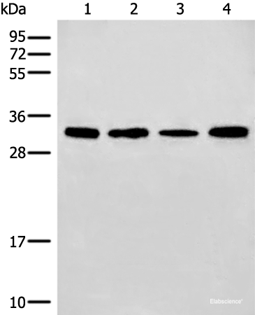 Western blot analysis of 293T and NIH/3T3 cell Mouse liver tissue lysates  using ERCC1 Polyclonal Antibody at dilution of 1:600